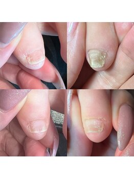 キュア(Cure.)/足の小指の形も美しく整う