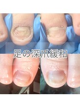 キュア(Cure.)/足の深爪も緩和して整う