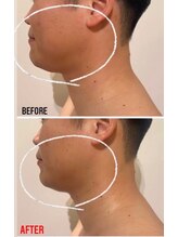 ルナグランデ(Luna grande.)/フェイスラインもスッキリ