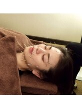 アポロボディケア 祐天寺店/美顔はり