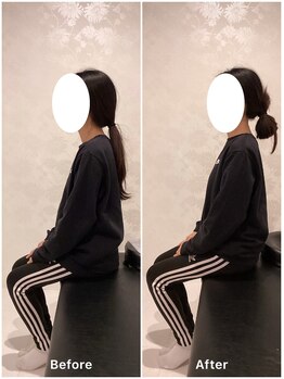 ナオル整体 福岡香椎院(NAORU整体)/40代女性施術事例【猫背】
