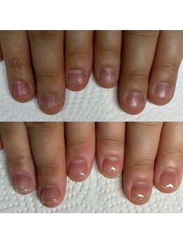 ウェルズユキ(well's yuki)/ジェルなし自爪育成