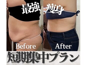 ラフィール/最強痩身：短期集中プラン