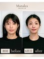 マナレア 湘南(Manalea)&nbsp;中顔面を短くして立体感のあるお顔をデザインするのが得意です！