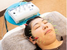 むろたはり きゅう院/【施術風景】美容鍼