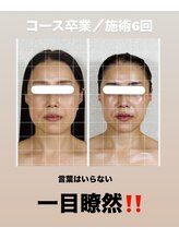 真美(Sinbi)/唯一無二の施術！！