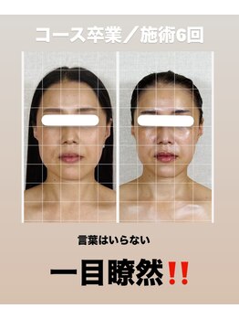 真美(Sinbi)/唯一無二の施術!!