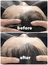 ことりと葉 平尾店/気になるおでこのシワまで！！