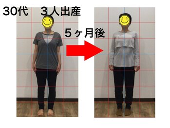 まもる整体サロン 新山口店/30代　３人出産で体型