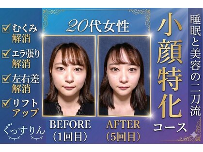 ぐっすりんの写真