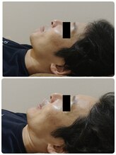 吉川美南ライフ整骨院/40代男性