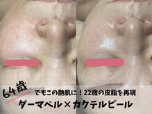 トータルビューティーサロンリア(Li'a)