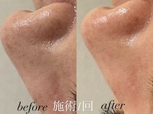 リスポアラボ(LIS PORE.LAB)/