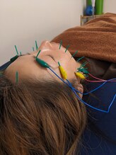 乃々鍼灸整体院 表参道/美容鍼