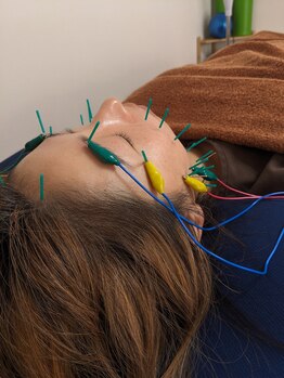 乃々鍼灸整体院 表参道/美容鍼