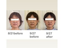 ブリリアント 西宮(Brilliant)/