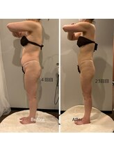 ソウソウビューティー 五反田(Shou Shou Beauty)/ビフォーアフター☆アフター