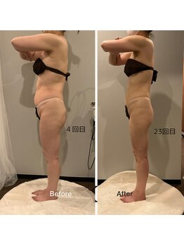 ソウソウビューティー 五反田(Shou Shou Beauty)/ビフォーアフター☆アフター