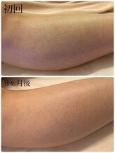 スリーズララ(Cerise LaLa)/