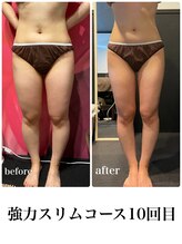 ピーラトゥ 日立(P-Ratu)/強力スリムコース