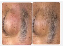 トータル ビューティ フィット/