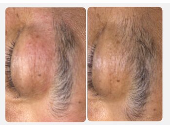 トータル ビューティ フィット/