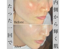 ブラックボックス(BLACK BOX)