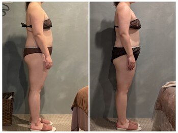 ツーアップ(2up)/お腹の厚み,背中肉,太もも前張り