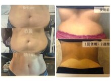 カラーリリー(calla lily)/脂肪おさらばレモンボトルボディ