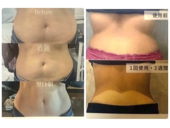 カラーリリー(calla lily)/脂肪おさらばレモンボトルボディ