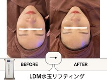 ビューティーワン(Beautyone)の雰囲気（韓国肌管理LDMでお悩みを根本改善[北浦和/エステ/都度払い]）