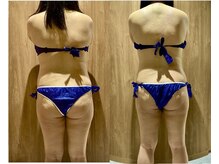 ソフィア(SOPHIA)の雰囲気（最新痩身高性能マシン【セルライトゼロ2】で本気のダイエット！）