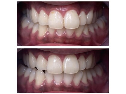 White base 【蘇我ホワイトニングサロン】の写真