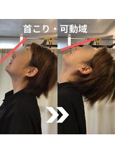 からだサロン サニー 堺東(SUNNY)/首こり・ストレートネック