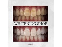 ホワイトニングショップ 徳島店の雰囲気（タバコによるヤニ汚れもしっかり落ちます！#ホワイトニング#徳島）