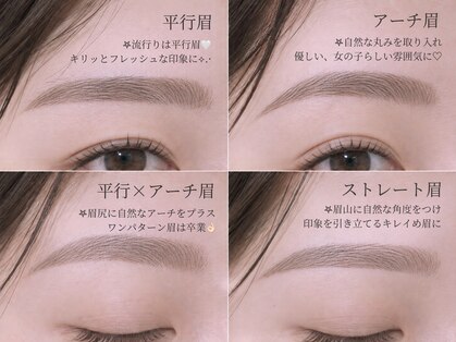 ミューズアイ(Muse eye)の写真