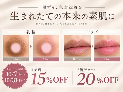 モンロー(MonroE+)の写真