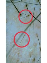 セラフ(Seraph)/白髪が黒髪へ