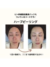 サクラ(Sakura)/剥離なしハーバルメソッド◎