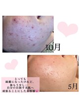 レスイズモア 恵比寿(less is more.)/20代女性　５ヶ月