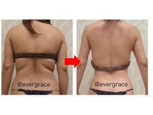 エヴァーグレース 金山店/二の腕背中流しで綺麗な後ろ姿に