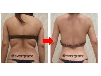 エヴァーグレース 金山店/二の腕背中流しで綺麗な後ろ姿に