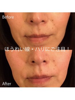 グレースフィオーレ 那覇店(gracefiore)/☆ビフォーアフター１９☆