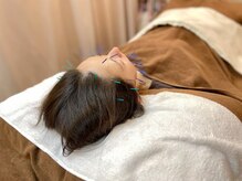 こじま 富雄団地接骨院/ヒト幹細胞美容鍼