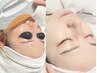 都度【白玉水光肌】フォト光フェイシャル+白玉グルタチオン導入+シェービング