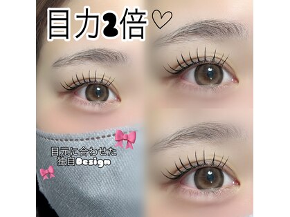 ミニョン(Mignon)の写真