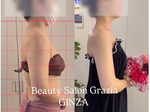 グラツィア 銀座(Grazia)/8回【 ブライダルエステ整体 】