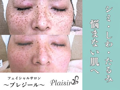 プレジール(plaisir)の写真
