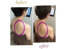 背中ラインが変わる！姿勢改善ケア　津市/リンパ/肩こり/むくみ