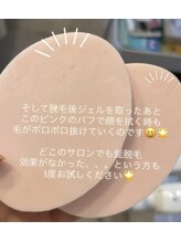 メロウ(mellow)/メンズヒゲ脱毛の効果☆